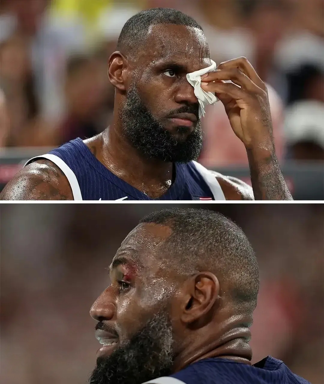 比赛中的惊险一幕引发球迷不断热议的简单介绍